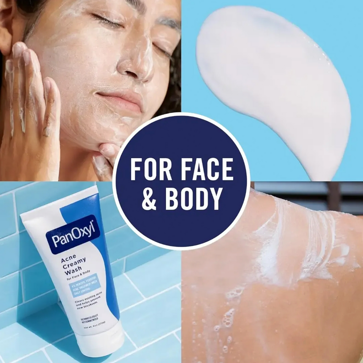 Acne Creamy Wash Face & Body 4% Benzoyl Peroxide