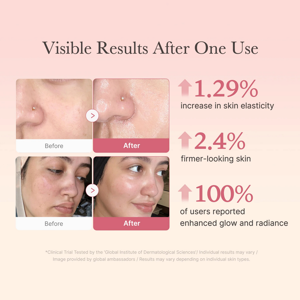 Medicube Collagen Jelly Cream 50 ml before and after infographic