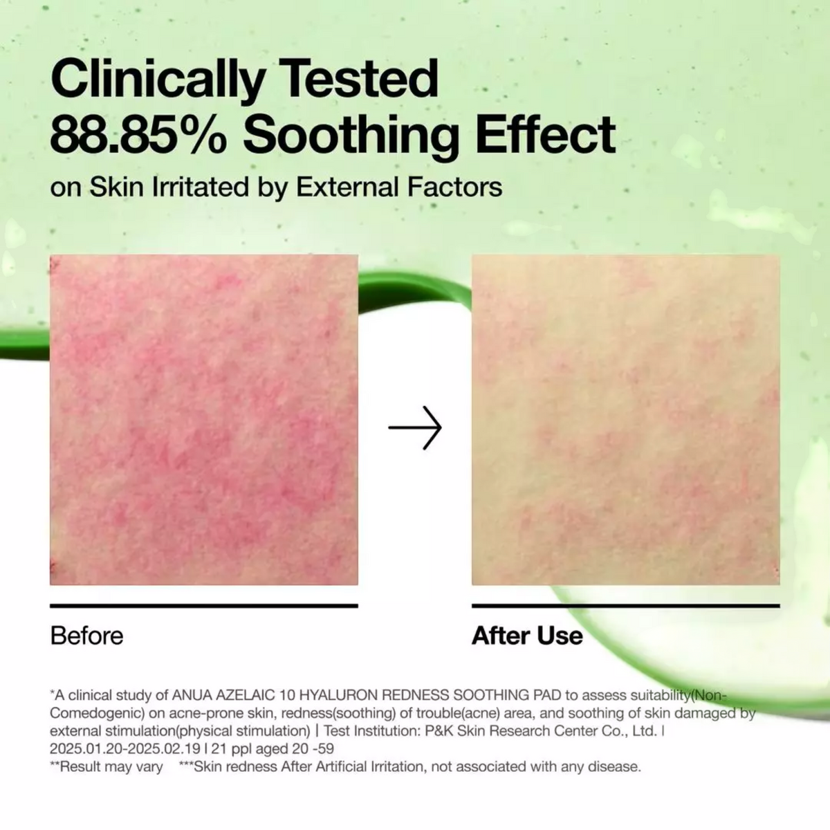 Azelaic 10 Hyaluron Redness Soothing Pad